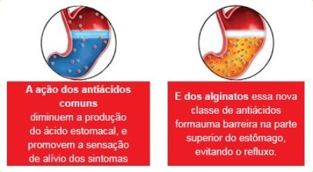 Queimação no estômago