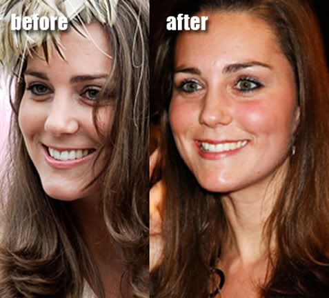 Catherine Middleton Catherine Middleton